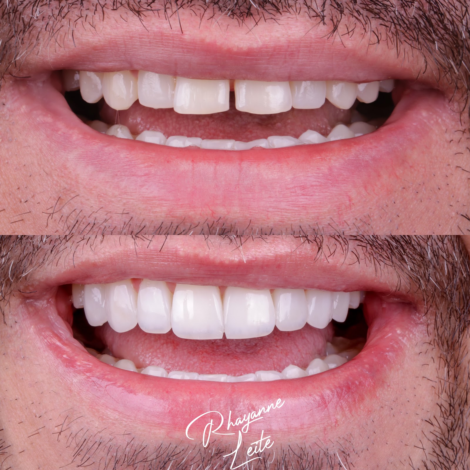 Sorriso depois do tratamento.